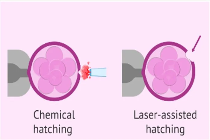 indications of assisted hatching